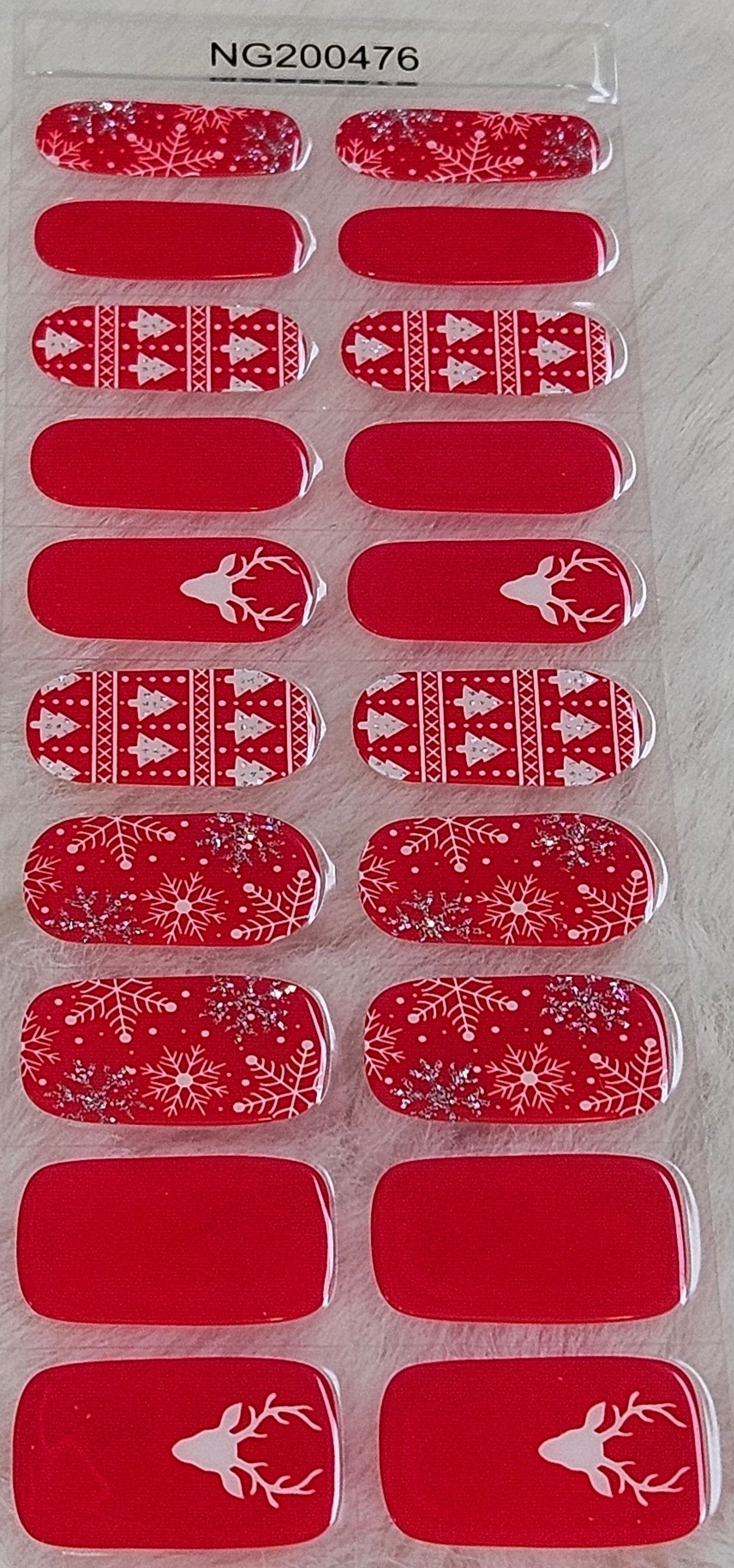 NG476